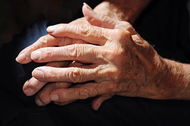 Arthritic Hands