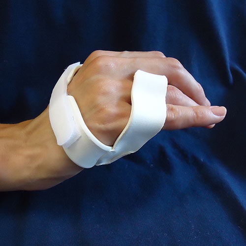 Ulnar Nerve Palsy Splint